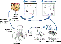Báo cáo ca bệnh hội chứng tăng nhiễm do giun lươn Strongyloides stercoralis trên bệnh nhân có hội chứng cushing do thuốc 