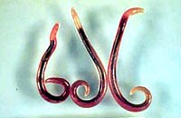 Phần 2: Bệnh ký sinh trùng đơn bào lây truyền qua đường thực phẩm- Một vấn đề sức khoẻ cộng đồng quan tâm