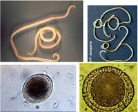 Chẩn đoán và điều trị ca bệnh nhiễm ấu trùng giun đũa chó, mèo Toxocara spp. ở người