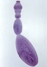 Một số thông tin cần thiết về sán dải chó Echinococcus granulosus 