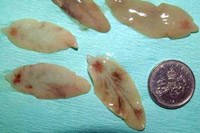 Cập nhật các nghiên cứu liên quan đến bệnh sán lá gan lớn (fascioliasis/fasciolopsiasis) và kháng thuốc Triclabendazole