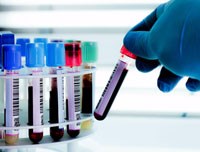 Điểm tin y tế từ các báo ngày 01/10 và 02/10 năm 2017