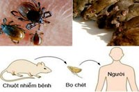 Cập nhật thông tin về dịch hạch