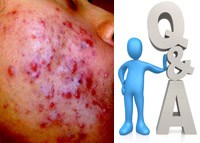 Q&A: Các bệnh về da, dị ứng của da do nhiễm khuẩn, nhiễm nấm, nhiễm ký sinh trùng, nhiễm virus