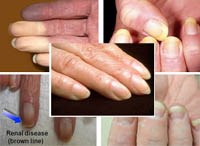 Trả lời bạn đọc các bệnh chuyên ngành ký sinh trùng tháng 01-2018