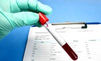 Một số điều cần lưu ý về các thông sô xét nghiệm trong cơ thể