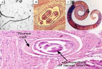 Phần 1: Cập nhật thông tin về giun xoắn Trichinella spiralis: bệnh ký sinh trùng gây nguy hiểm chết người