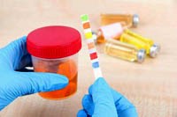 Đánh giá lâm sàng các thông số trong nước tiểu qua máy phân tích nước tiểu tự động 10 và 14 thông số