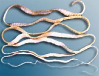 Chia sẻ kinh nghiệm từ một số thông tin về ký sinh trùng ở người mới nhất 2017-2018