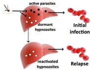Tổng hợp các nghiên cứu về kháng thuốc sốt rét dưới góc độ phân tử