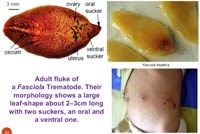 Phần 1: Tổng hợp các nghiên cứu về chẩn đoán hình ảnh trên bệnh nhân sán lá gan lớn trên thế giới và Việt Nam