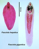 Phần 2: Tổng hợp các nghiên cứu về chẩn đoán hình ảnh trên bệnh nhân sán lá gan lớn trên thế giới và Việt Nam