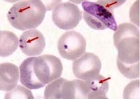 Nghiên cứu cho thấy ký sinh trùng sốt rét tập trung trong tủy xương