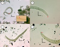 Phần 1: Nghiên cứu phân tích phân tử về định loài giun lươn gây bệnh ở người