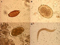 Phần 2: Nghiên cứu phân tích phân tử về định loài giun lươn gây bệnh ở người