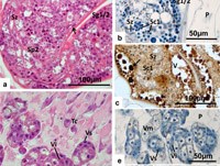 Cập nhật một số công trình nghiên cứu về sán lá gan lớn kháng thuốc triclabendazole trên thế giới và Việt Nam