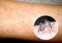 Điểm tin y tế từ các báo ngày 01/4 đến ngày 10/4 năm 2018 