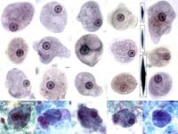 Phần 2: Nghiên cứu bệnh lý đơn bào ở người chưa được quan tâm đúng mực về phương diện bệnh tiêu hóa