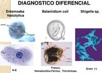 Phần 3: Nghiên cứu bệnh lý đơn bào ở người chưa được quan tâm đúng mực về phương diện bệnh tiêu hóa
