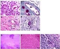 Phần 4: Nghiên cứu bệnh lý đơn bào ở người chưa được quan tâm đúng mực về phương diện bệnh tiêu hóa