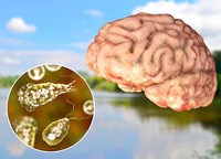 Phần 1: Nghiên cứu về tổn thương não màng não do loài amip ăn não người Naeglaria fowleri vẫn còn bỏ ngõ và tỷ lệ tử vong còn cao