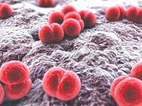 Cập nhật tình hình về nguy cơ dịch viêm màng não mô cầu type C