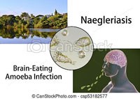 Phần 4: Nghiên cứu về tổn thương não màng não do loài amip ăn não người Naeglaria fowleri vẫn còn bỏ ngõ và tỷ lệ tử vong còn cao
