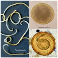 Phần 2: Cập nhật thông tin về nghiên cứu ấu trùng giun đũa chó mèo Toxocara spp. gây bệnh ở người