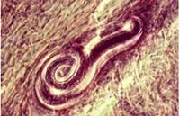 Bệnh ký sinh trùng lây truyền từ động vật sang người: Bệnh giun xoắn