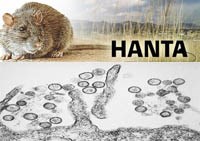 Một số thông tin cần thiết về bệnh sốt xuất huyết do vi-rút Hanta