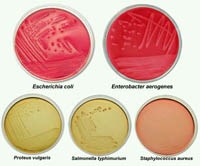 Phần 2. Cập nhật một số nghiên cứu vi khuẩn Escherichia coli 
