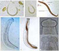 Cập nhật một số nghiên cứu về bệnh ký sinh trùng ở người và động vật