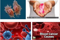 Phần 3. Cập nhật thông tin về nghiên cứu ứng dụng các chỉ điểm hay dấu ấn khối u trong chẩn đoán ưng thư và bềnh lý u lành tính