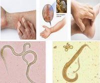 Chuyên mục trả lời hỏi đáp bệnh chuyên ngành sốt rét, ký sinh  trùng và côn trùng y học (tháng 4 đến tháng 10 năm 2018)