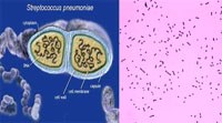 Phần 2. Cập nhật thông tin nghiên cứu về phế cầu Strptococcus pneumoniae kháng thuốc     