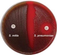 Phần 5. Cập nhật thông tin nghiên cứu về phế cầu Strptococcus pneumoniae kháng thuốc      