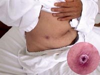 Phần 2. Cập nhật các công trình nghiên cứu về dịch tễ học bệnh sốt mò