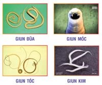  Những điều cần biết về bệnh giun sán và cách phòng chống