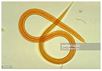 Phần 1.Cập nhật một số nghiên  cứu về bệnh ấu trùng giun lươn ở người