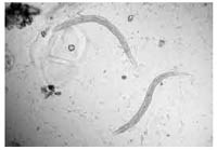Phần 2. Cập nhật một số nghiên cứu về bệnh ấu trùng giun lươn ở người