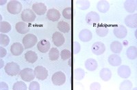 Phần 3: Cập nhật về các nghiên cứu liên quan đến vector sốt rét trên thế giới và Việt Nam
