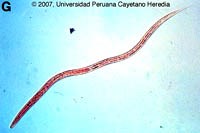 Phần 5: Cập nhật một số nghiên cứu về bệnh ấu trùng giun lươn ở người