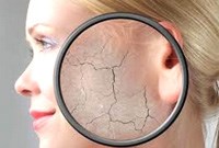 Q&A:  Một số thông tin cần biết về da và dị ứng da (Phần 1)