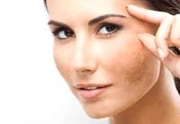 Q&A: Một số câu hỏi liên quan đến da và dị ứng da (Phần 2)