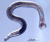Phần 2: Ancylostoma ceylanicum: một tác nhân đang nổi nhưng lại là bệnh ký sinh trùng truyền từ động vật sang người bị lãng quên