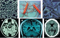 Một số thông tin về bệnh sán dây và ấu trùng sán dây ở người (Update on Human Taeniasis and Cysticercosis)