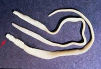 Một số thông tin liên quan đến quản lý và điều trị bệnh sán dây/ấu trùng sán dây lợn