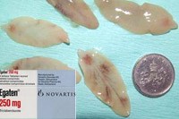 Thông tin mới về chấp thuận của cơ quan quản lý thực dược phẩm với thuốc điều trị sán lá gan lớn loại Triclabendazole (FDA Approves Triclabendazole for Treatment of Fascioliasis)