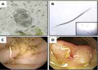 Phần 1: Ancylostoma ceylanicum: Tác nhân ký sinh trùng đang nổi truyền từ động vật sang người đang bị lãng quên