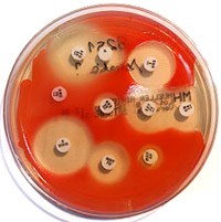 Cập nhật về loài vi khuẩn mới Serratia marcescens tác động đến sức khỏe con người và thực phẩm